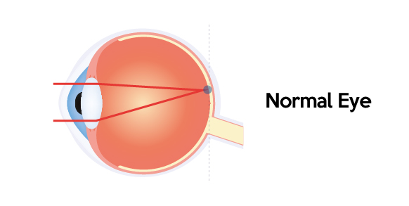 Normal eye ball