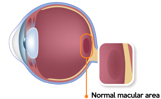 normal macula