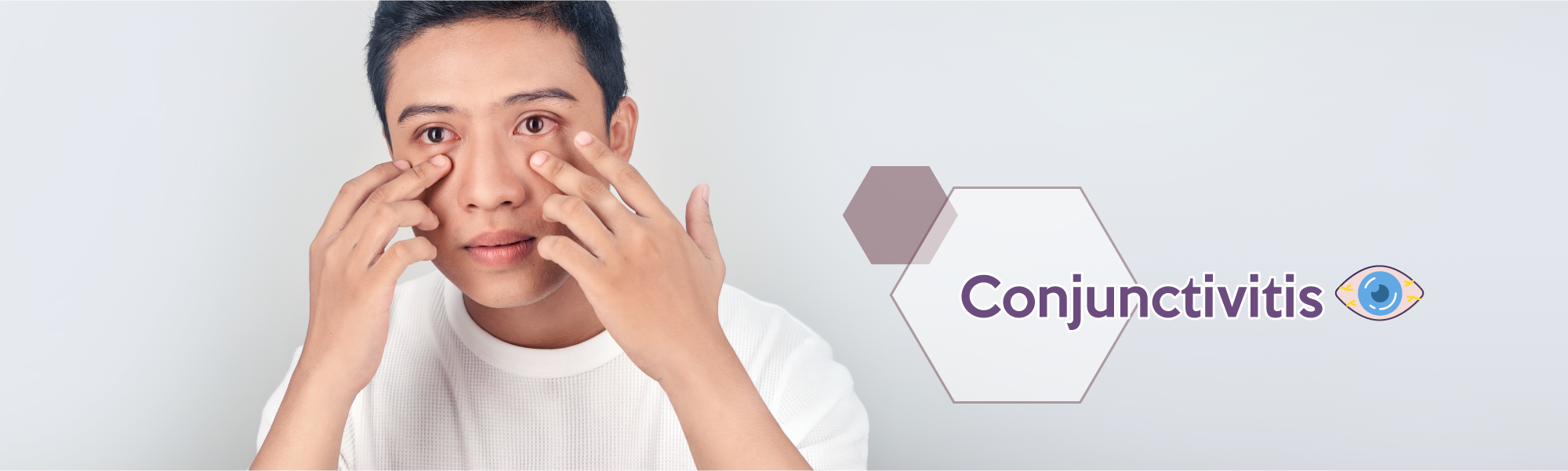 Conjunctivitis