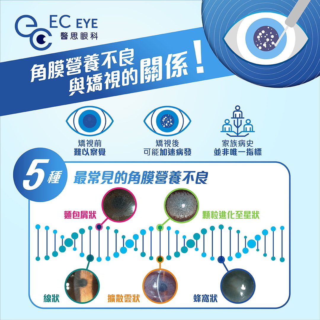 全新矫视风险基因测试| EC EYE 医思眼科