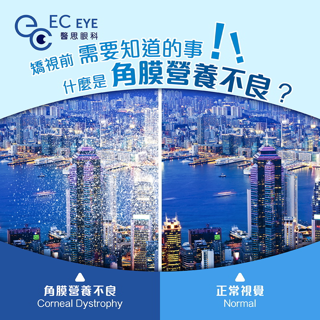 全新矫视风险基因测试| EC EYE 医思眼科
